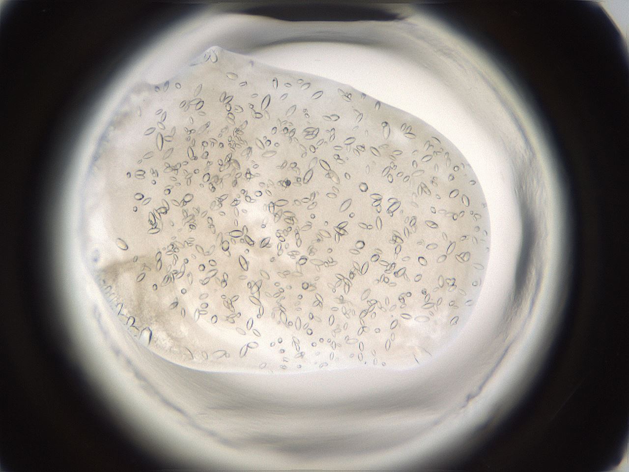 folderID661_plateID1661_batchID6964_wellNum63_profileID1_d1_r110561_ef.jpg