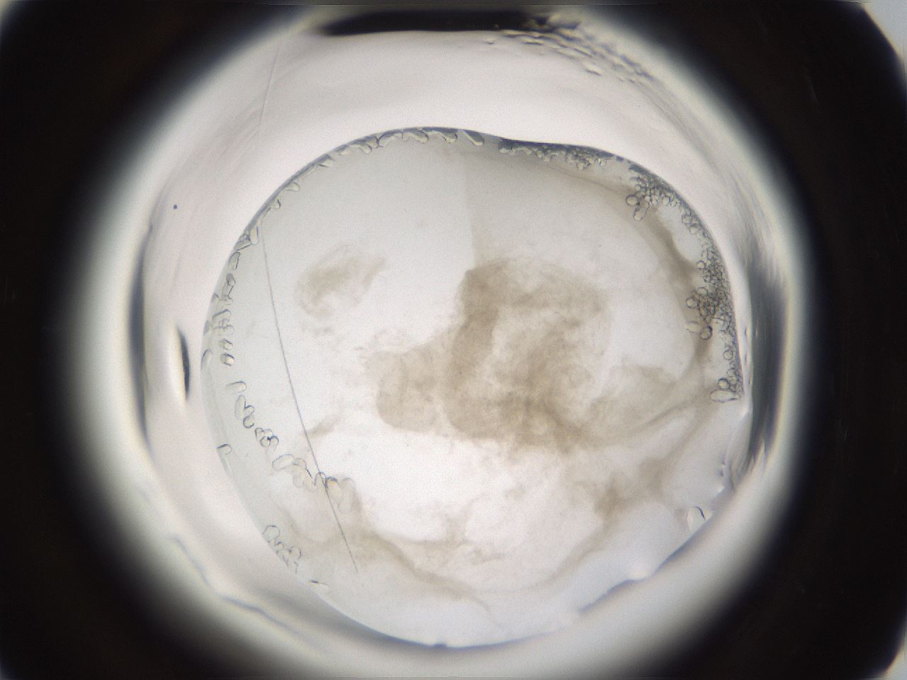 folderID661_plateID1661_batchID6964_wellNum89_profileID1_d3_r110623_ef.jpg