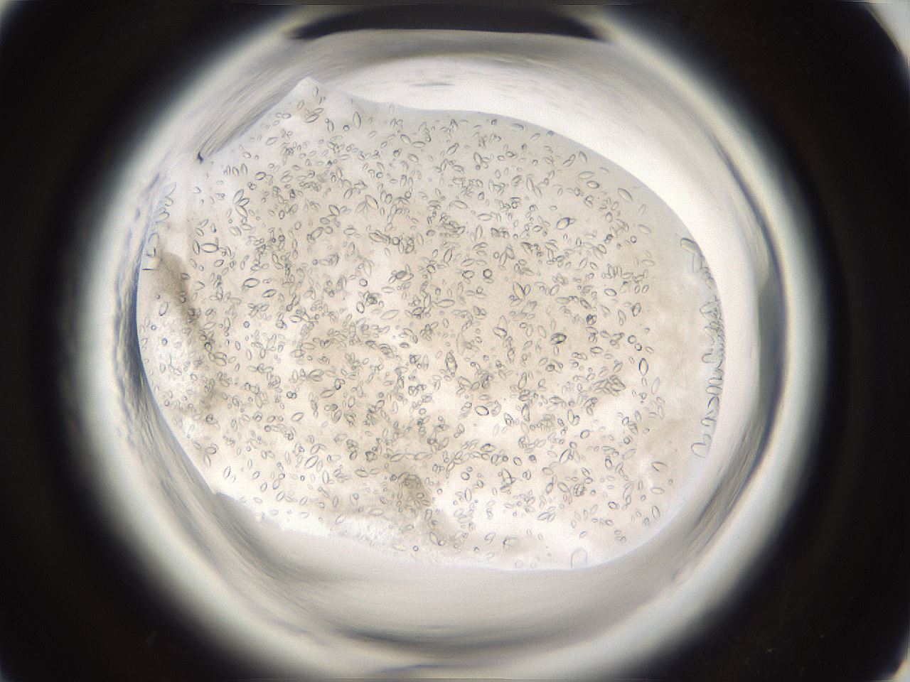 folderID661_plateID1661_batchID6964_wellNum92_profileID1_d1_r110630_ef.jpg