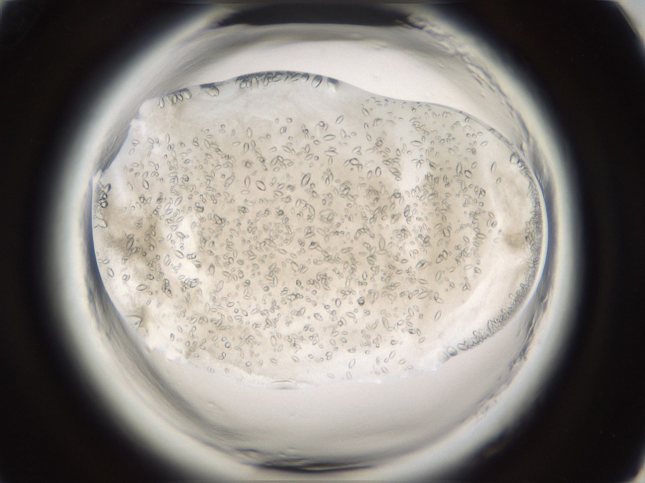 folderID661_plateID1661_batchID6964_wellNum93_profileID1_d1_r110633_ef.jpg