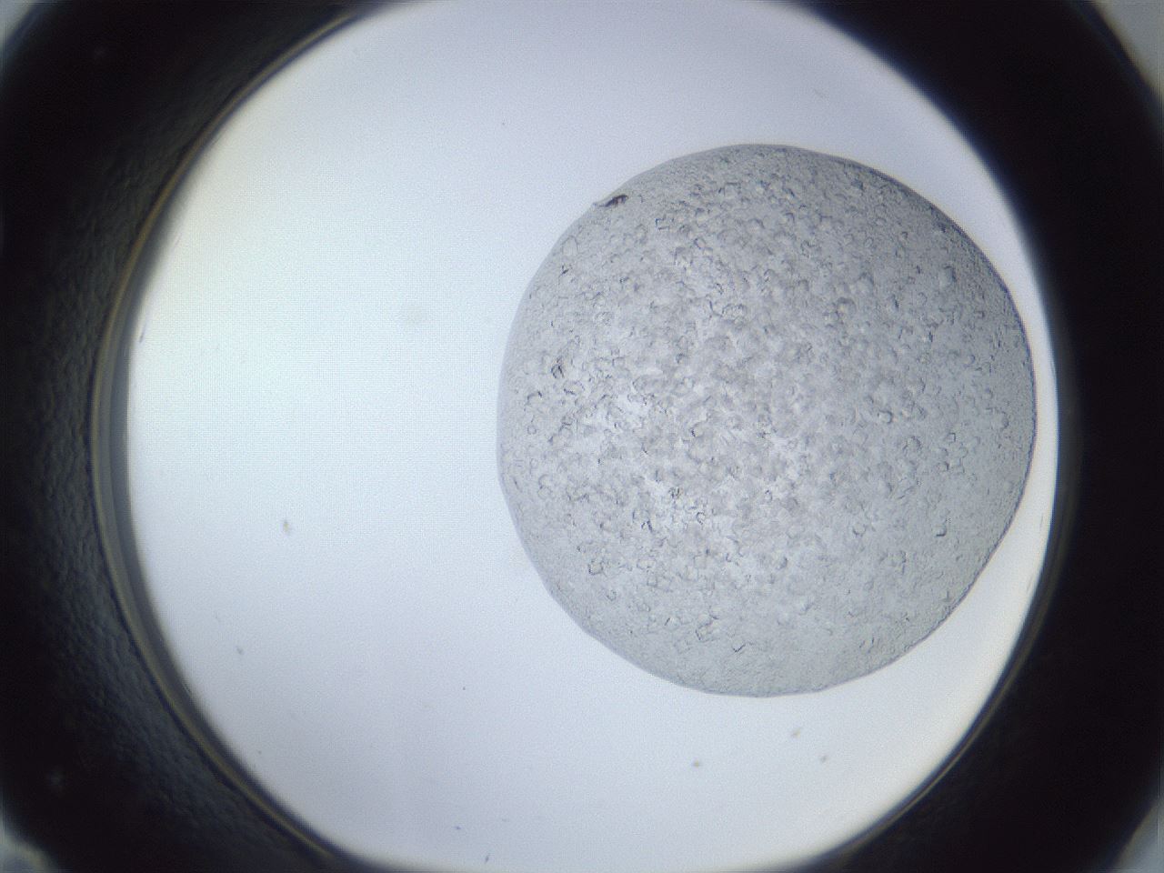 folderID879_plateID879_batchID1098_wellNum71_profileID1_d1_r31643_ef.jpg