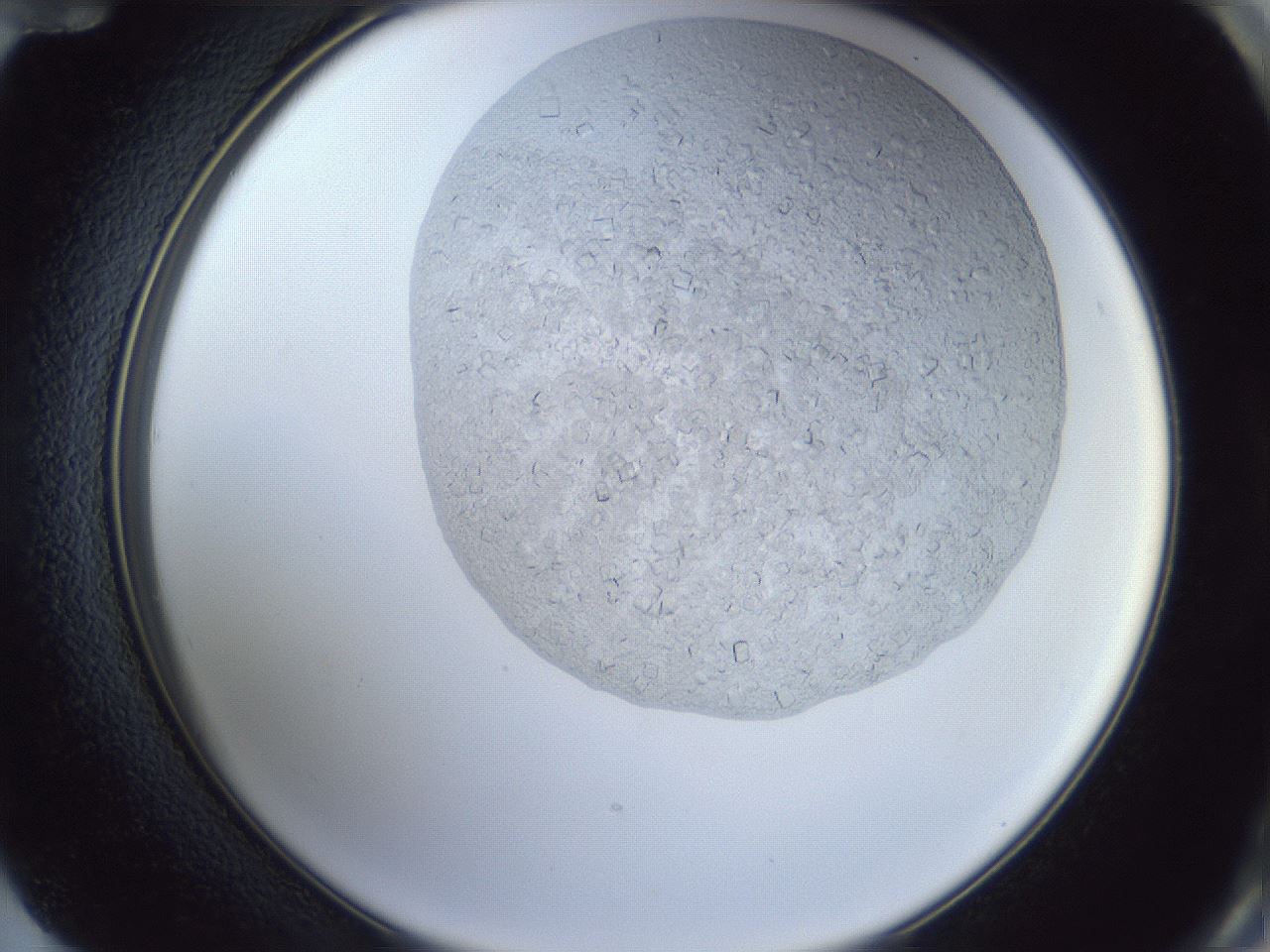 folderID879_plateID879_batchID1098_wellNum72_profileID1_d2_r31646_ef.jpg