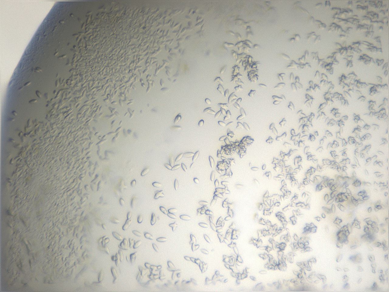 folderID884_plateID1884_batchID7977_wellNum49_profileID1_d1_r126802_ef.jpg