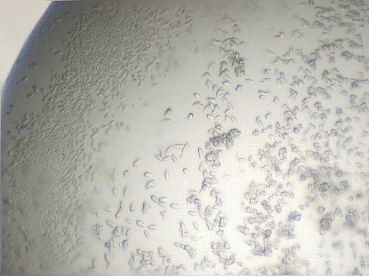 folderID884_plateID1884_batchID8008_wellNum49_profileID1_d1_r126802_ef.jpg