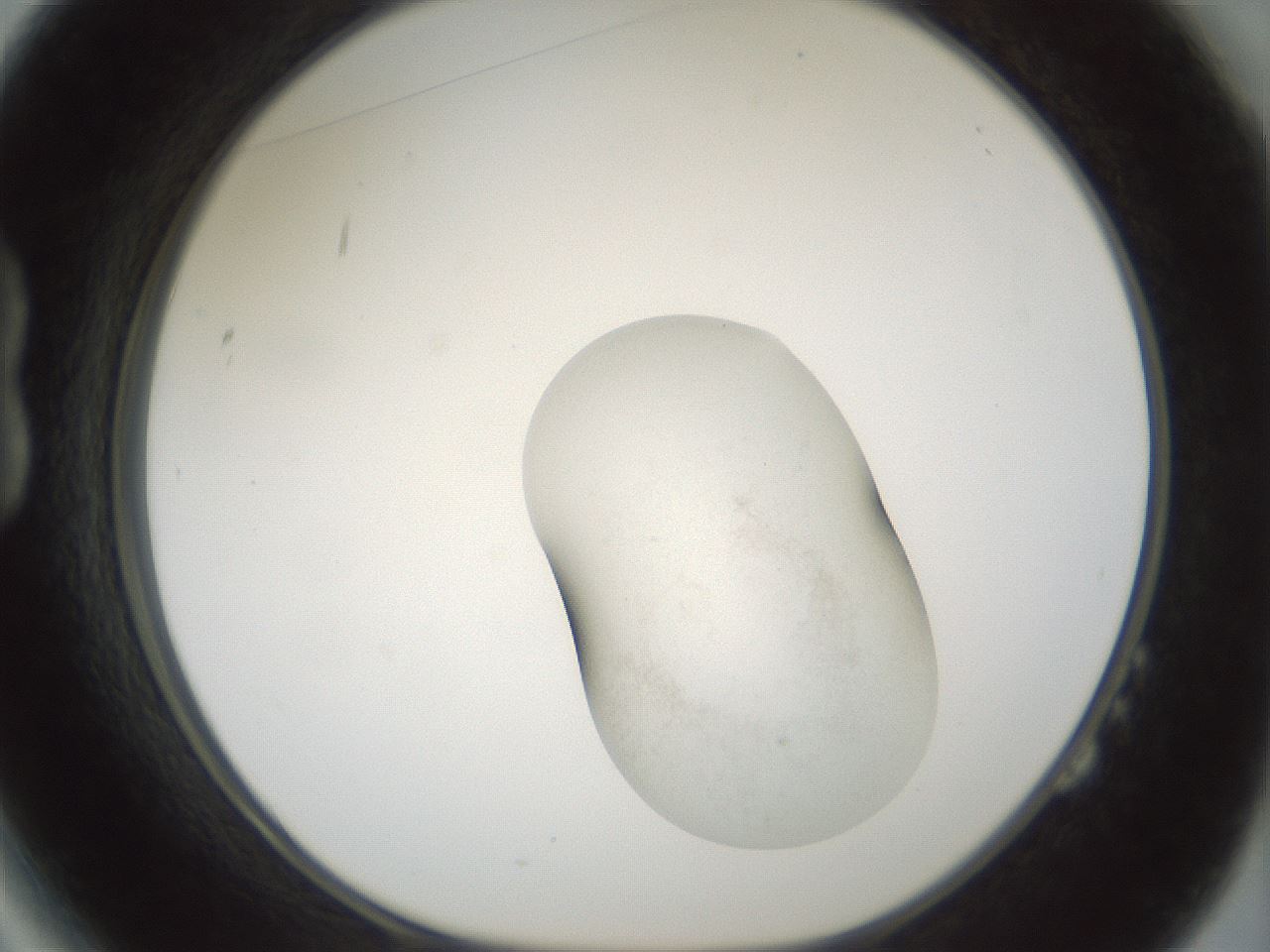 folderID102_plateID3102_batchID17407_wellNum14_profileID1_d1_r260278_ef.jpg