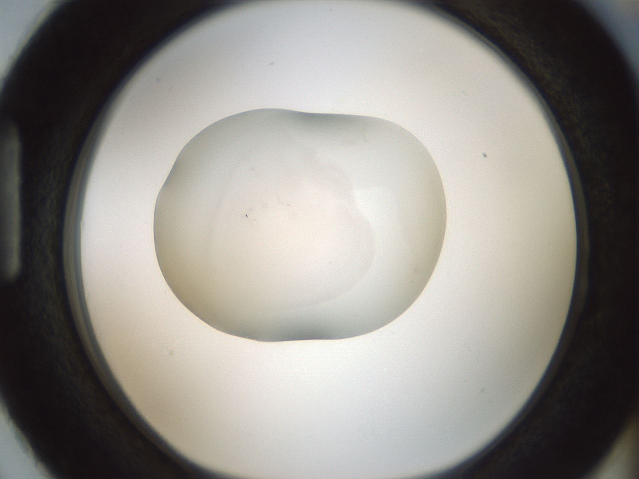 folderID106_plateID3106_batchID17912_wellNum87_profileID1_d1_r263509_ef.jpg