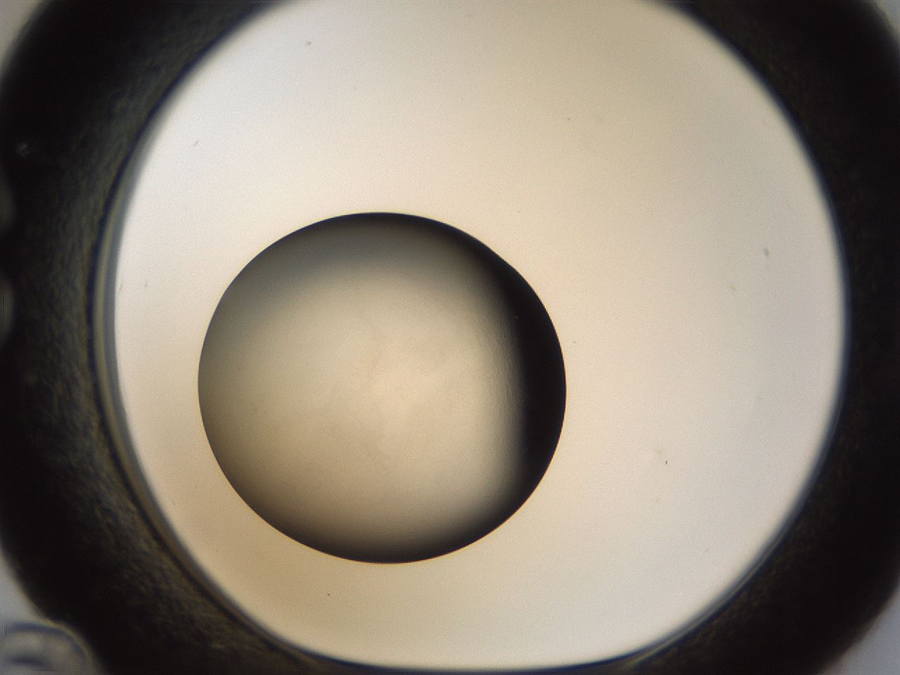 folderID112_plateID1112_batchID2600_wellNum36_profileID1_d1_r56953_ef.jpg