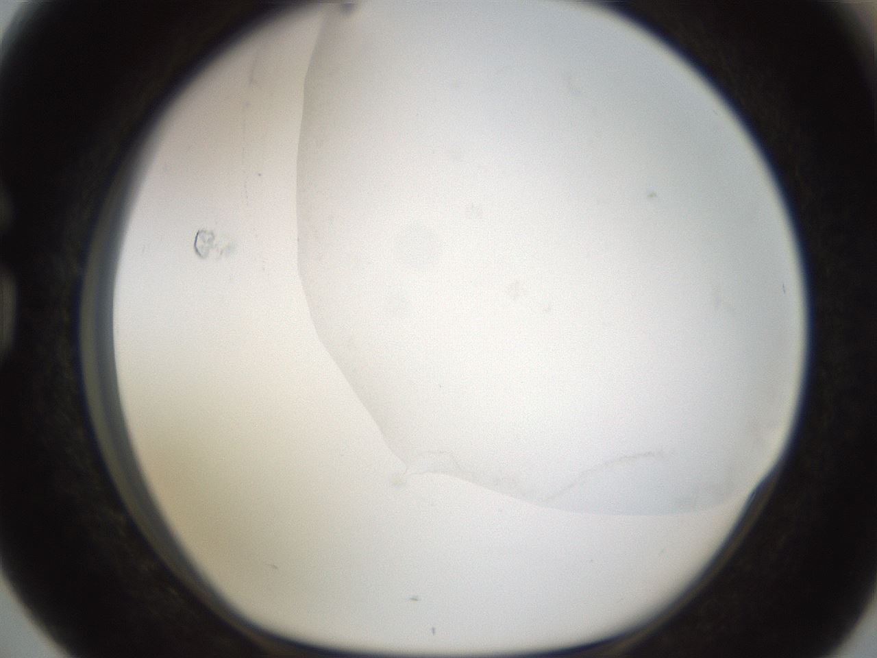 folderID175_plateID1175_batchID2794_wellNum76_profileID1_d1_r64330_ef.jpg