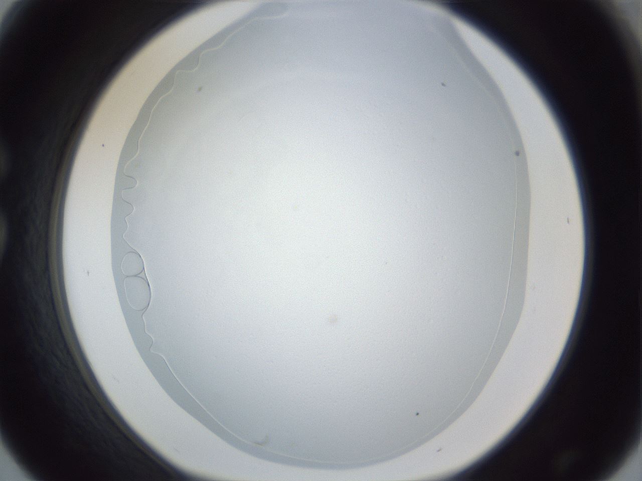 folderID218_plateID1218_batchID3861_wellNum30_profileID1_d1_r69402_ef.jpg