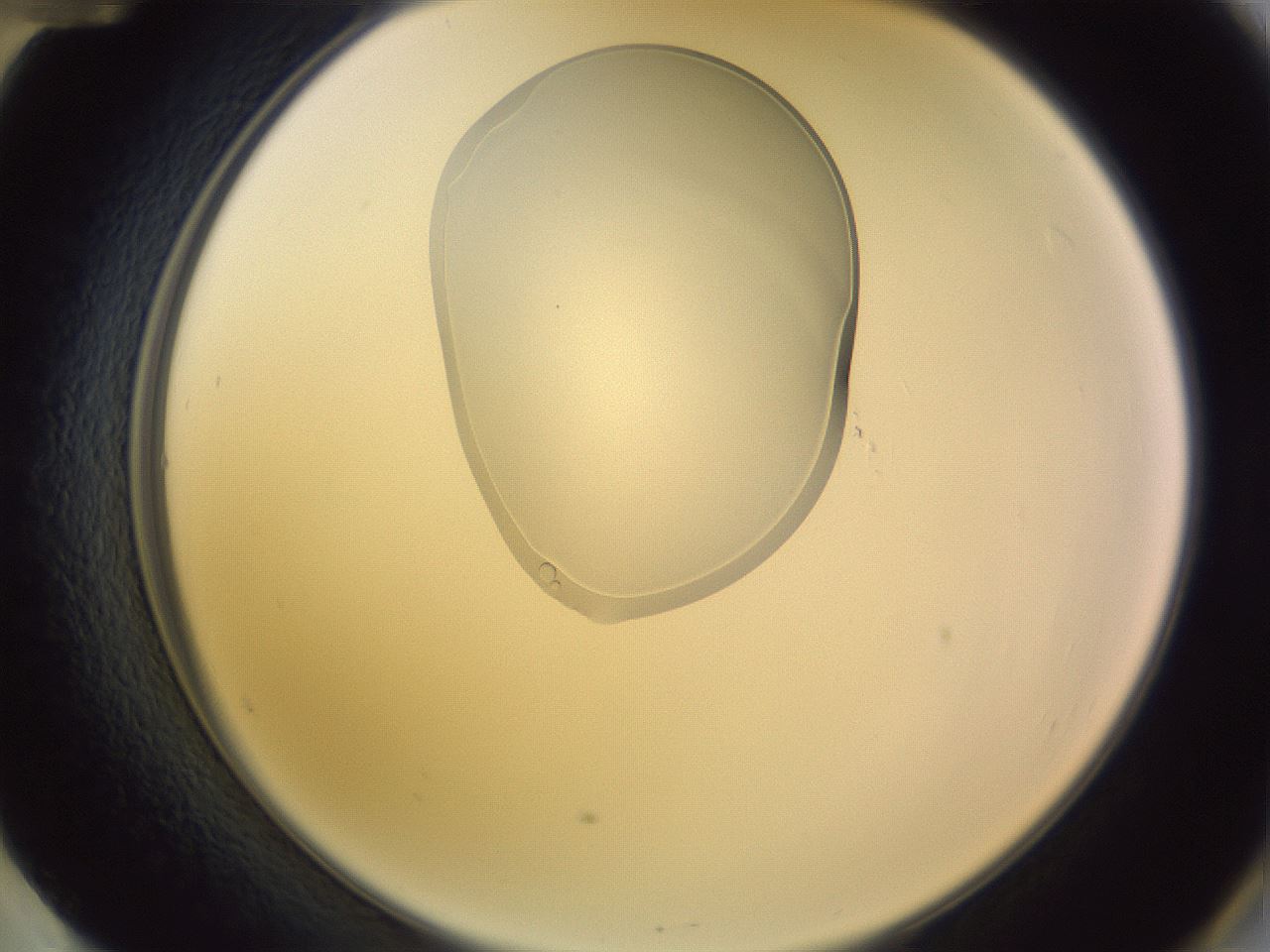 folderID281_plateID1281_batchID4424_wellNum60_profileID1_d2_r75951_ef.jpg