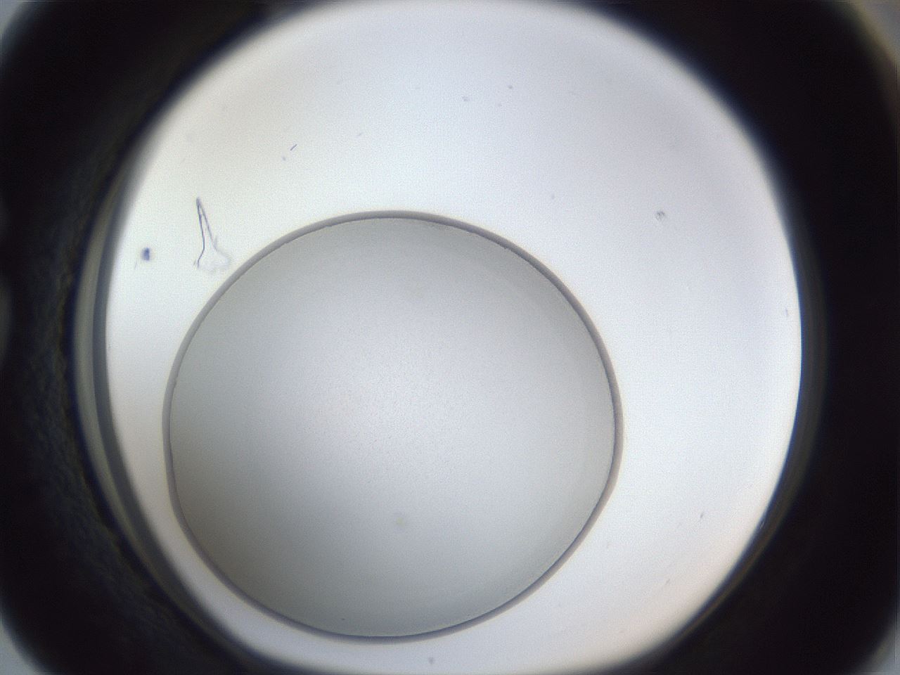 folderID31_plateID1031_batchID1862_wellNum76_profileID1_d1_r44474_ef.jpg