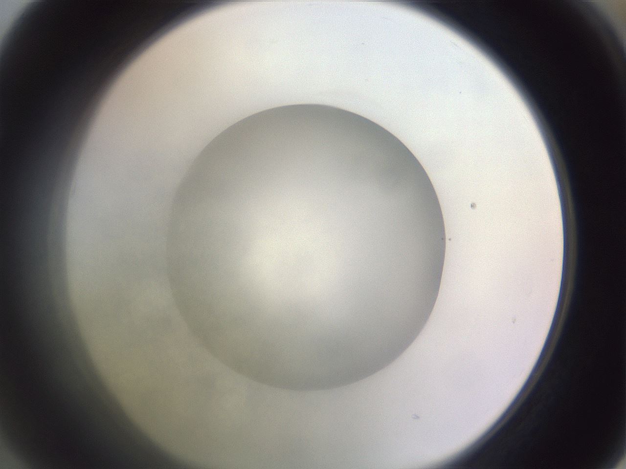folderID416_plateID1416_batchID5320_wellNum53_profileID1_d1_r86854_ef.jpg