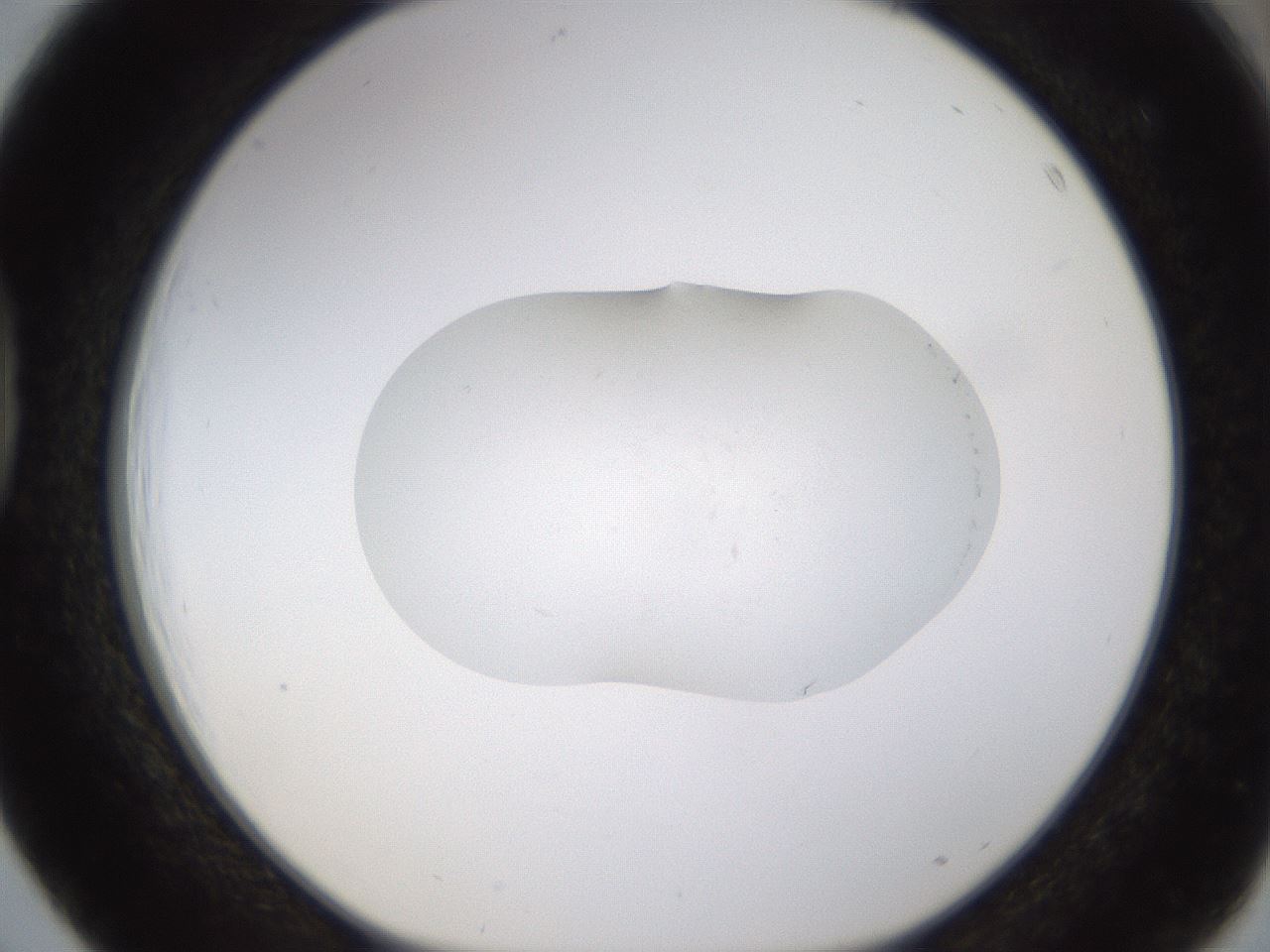 folderID422_plateID1422_batchID5125_wellNum39_profileID1_d1_r87416_ef.jpg