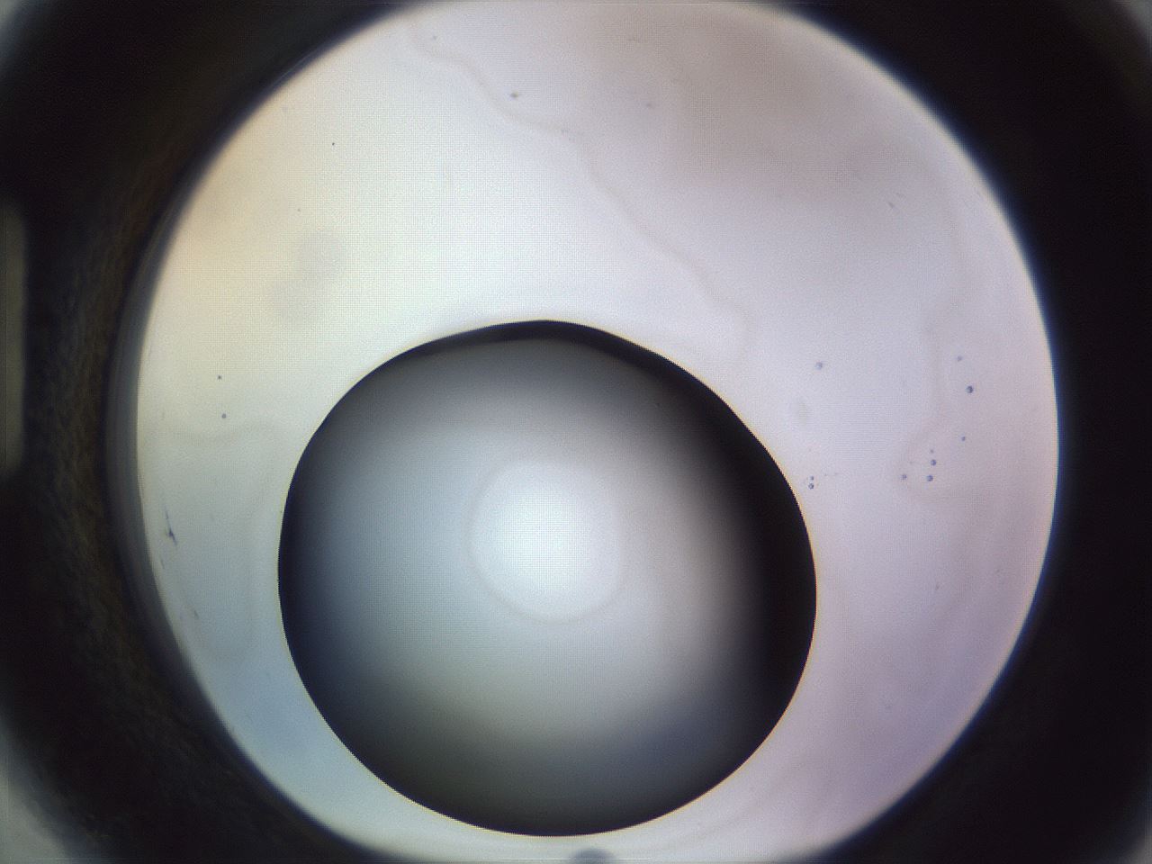 folderID451_plateID1451_batchID5640_wellNum89_profileID1_d1_r91892_ef.jpg
