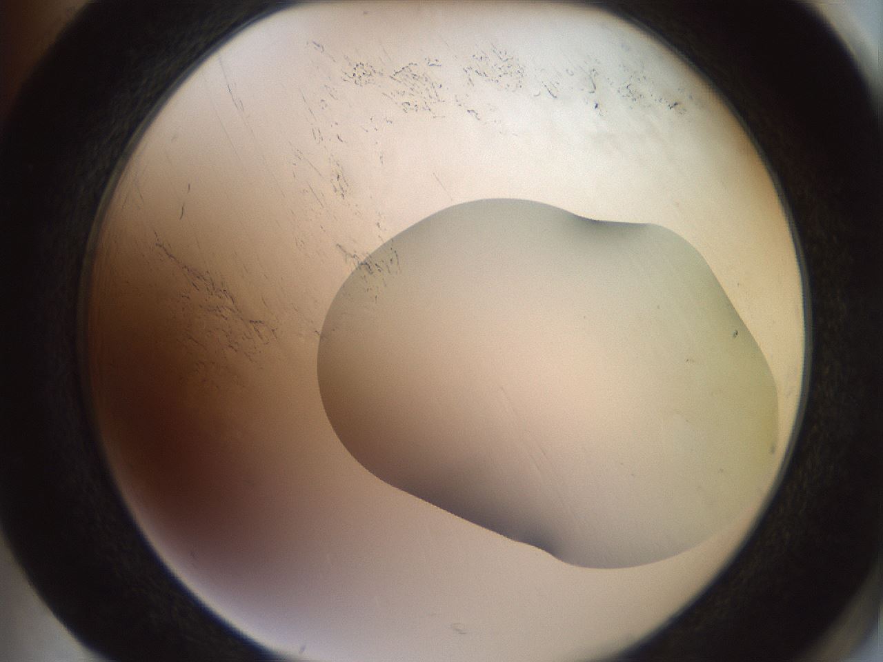 folderID502_plateID3502_batchID22119_wellNum85_profileID1_d2_r314287_ef.jpg