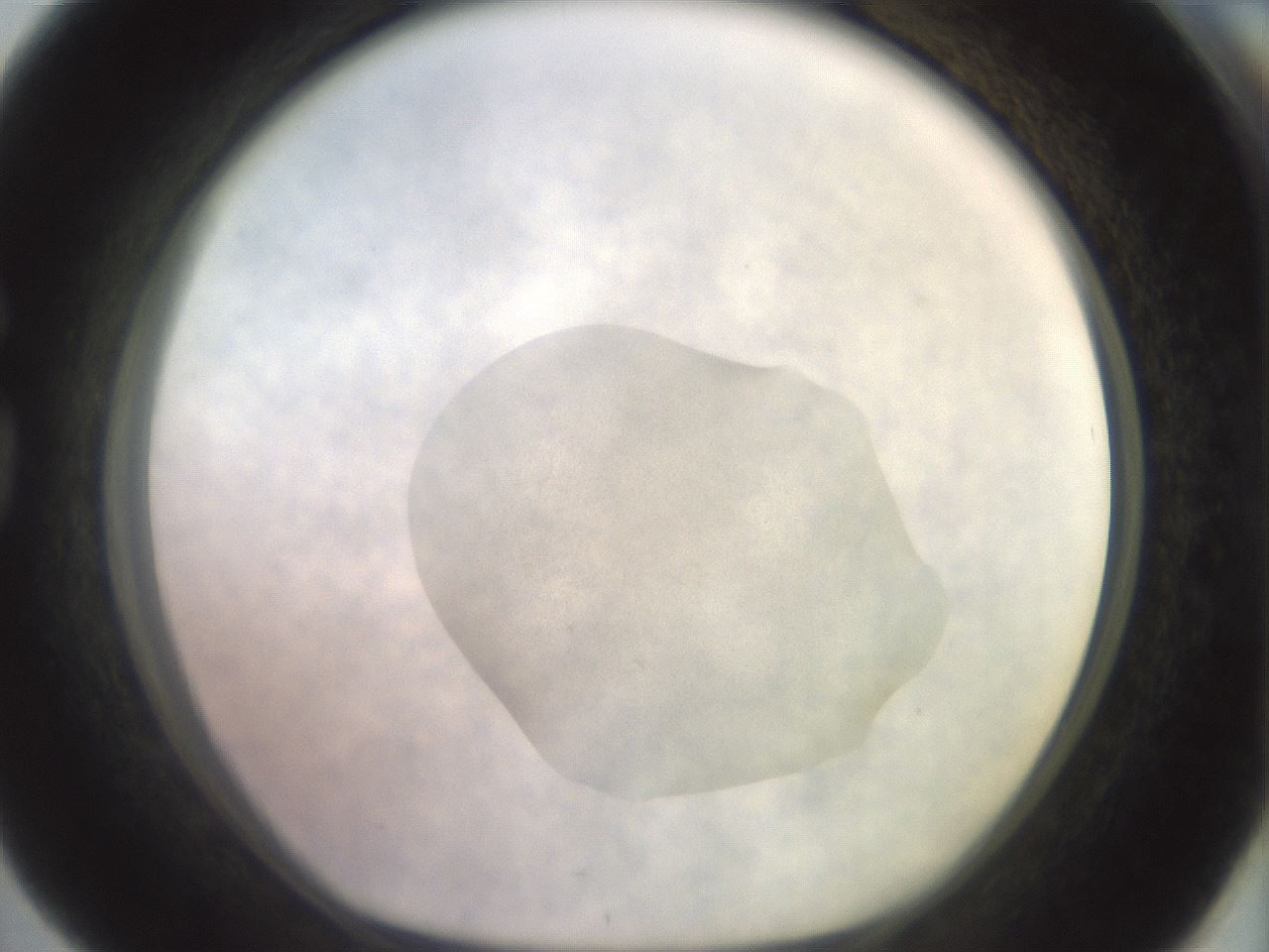 folderID556_plateID3556_batchID20817_wellNum76_profileID1_d1_r317658_ef.jpg