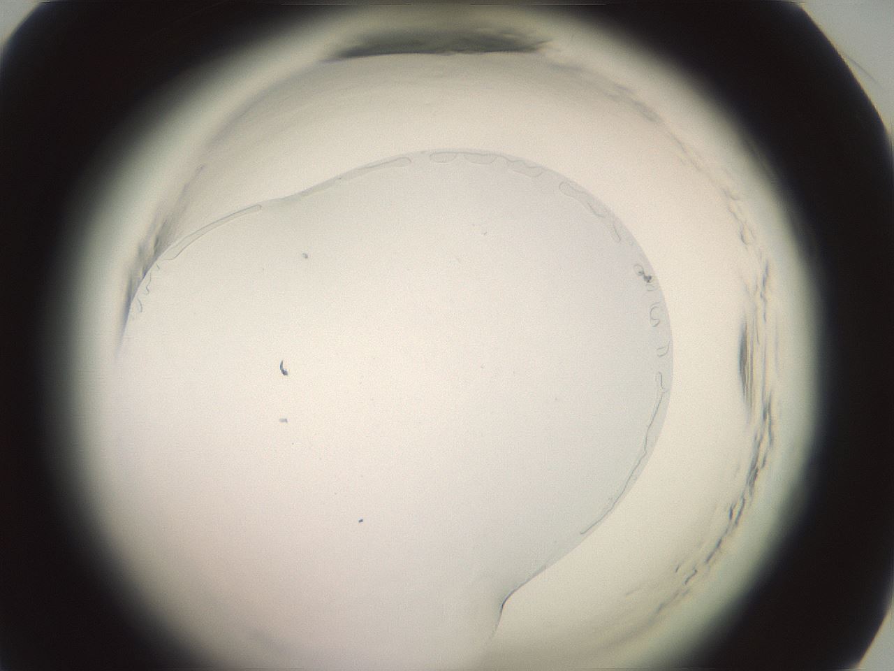 folderID577_plateID2577_batchID12827_wellNum46_profileID1_d1_r198576_ef.jpg