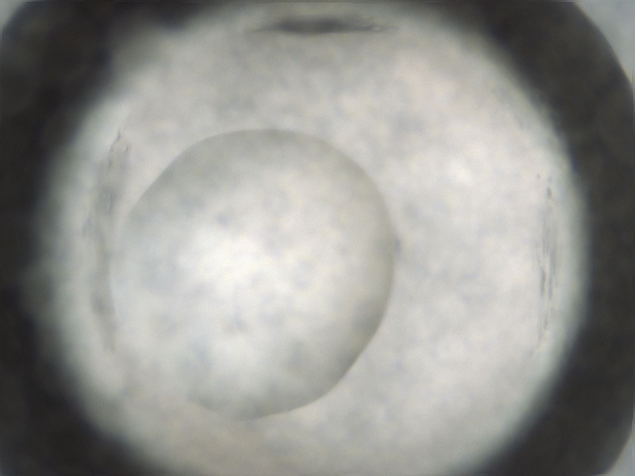 folderID586_plateID2586_batchID13469_wellNum57_profileID1_d2_r206099_ef.jpg