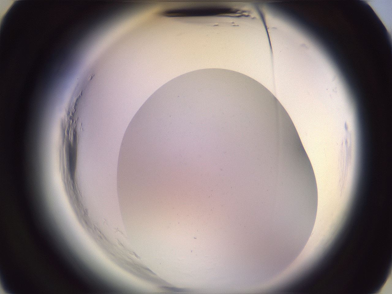 folderID600_plateID2600_batchID12878_wellNum16_profileID1_d3_r198776_ef.jpg