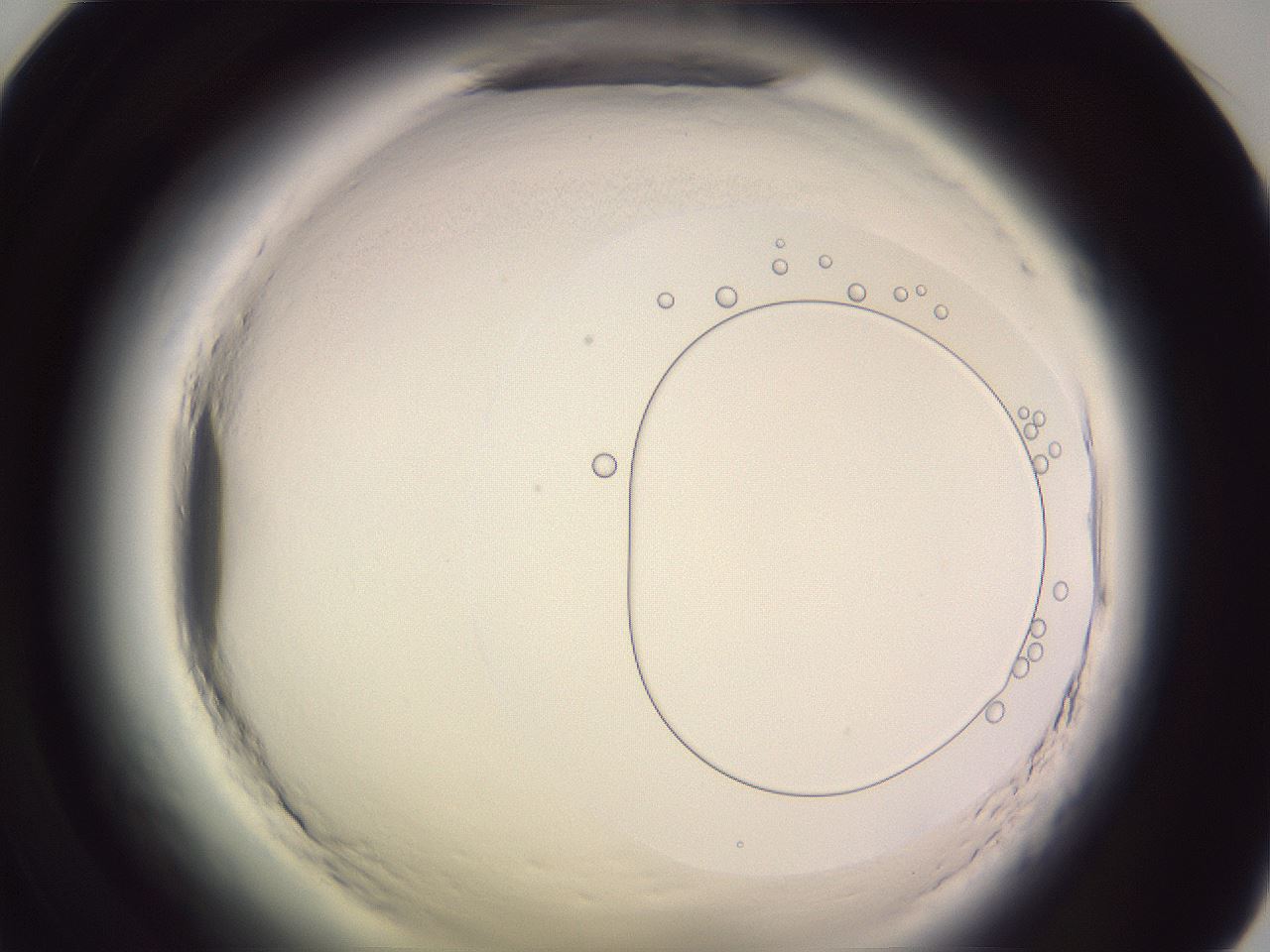 folderID606_plateID2606_batchID14325_wellNum59_profileID1_d1_r203800_ef.jpg