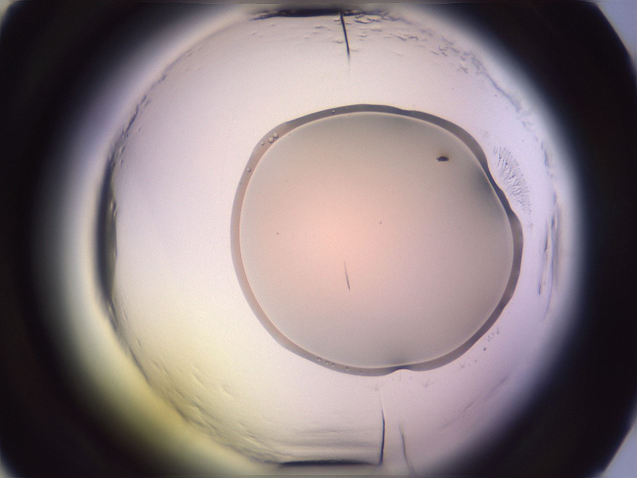 folderID612_plateID2612_batchID14862_wellNum13_profileID1_d2_r205679_ef.jpg
