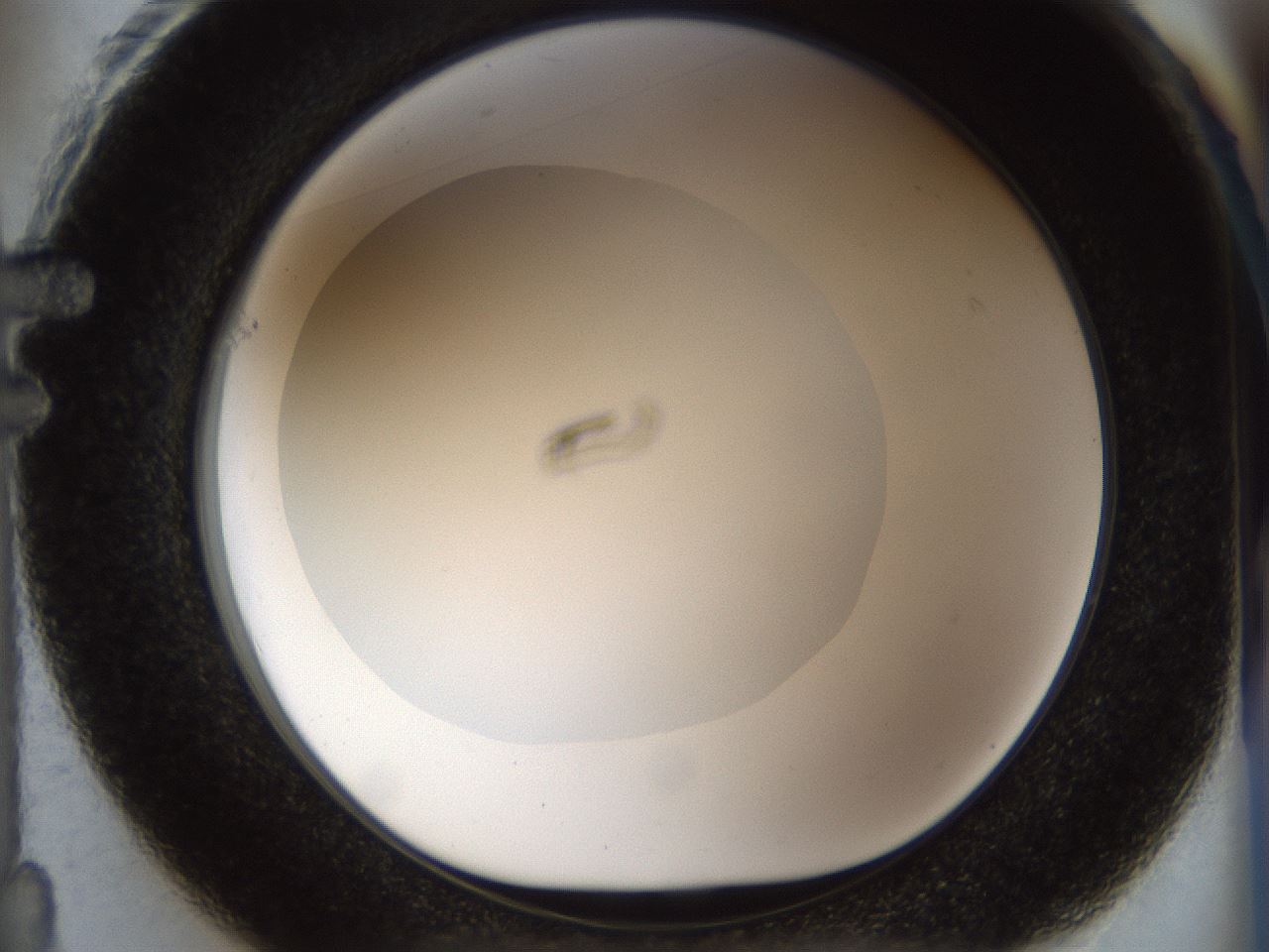 folderID863_plateID863_batchID1020_wellNum61_profileID1_d1_r29895_ef.jpg