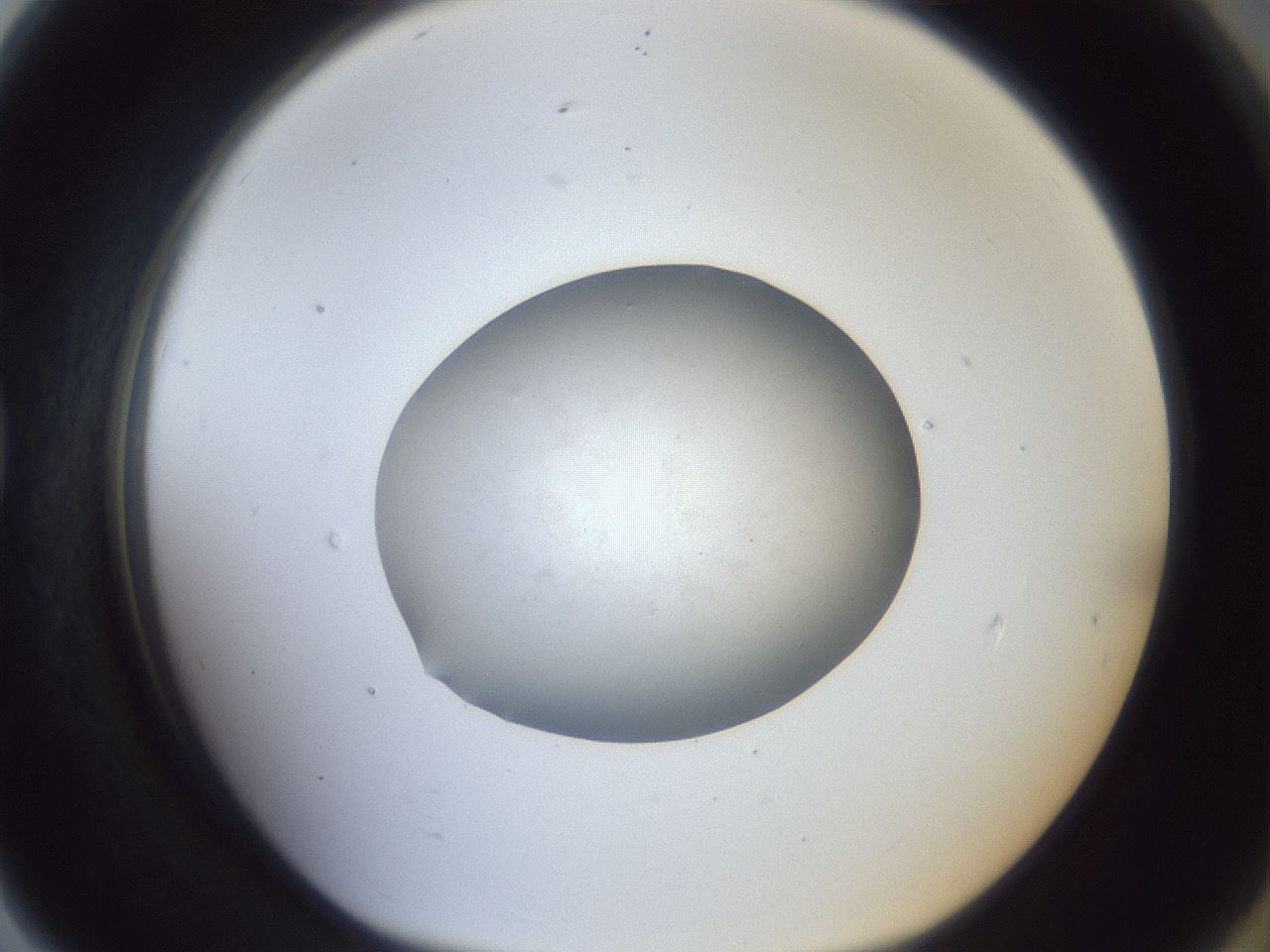 folderID925_plateID925_batchID1163_wellNum79_profileID1_d1_r33639_ef.jpg