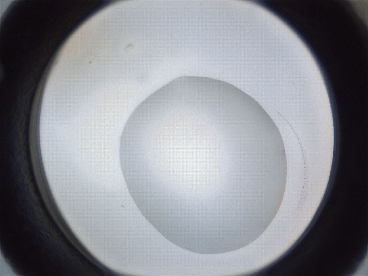 folderID927_plateID927_batchID1164_wellNum63_profileID1_d1_r33823_ef.jpg