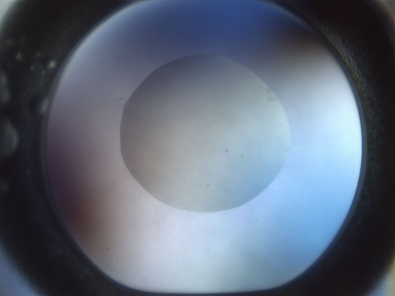 folderID932_plateID1932_batchID8218_wellNum75_profileID1_d1_r128987_ef.jpg