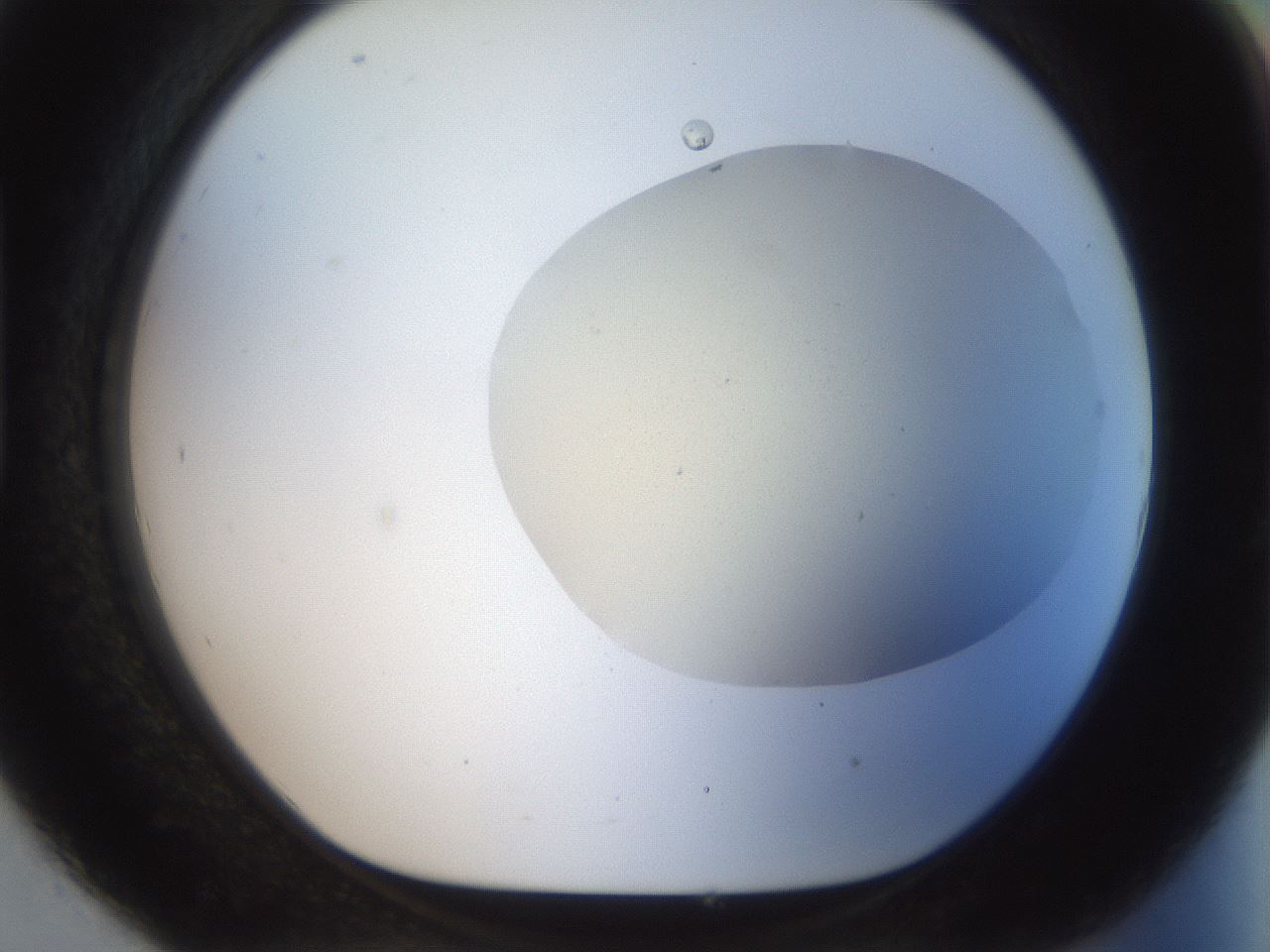 folderID933_plateID1933_batchID8219_wellNum93_profileID1_d1_r129101_ef.jpg
