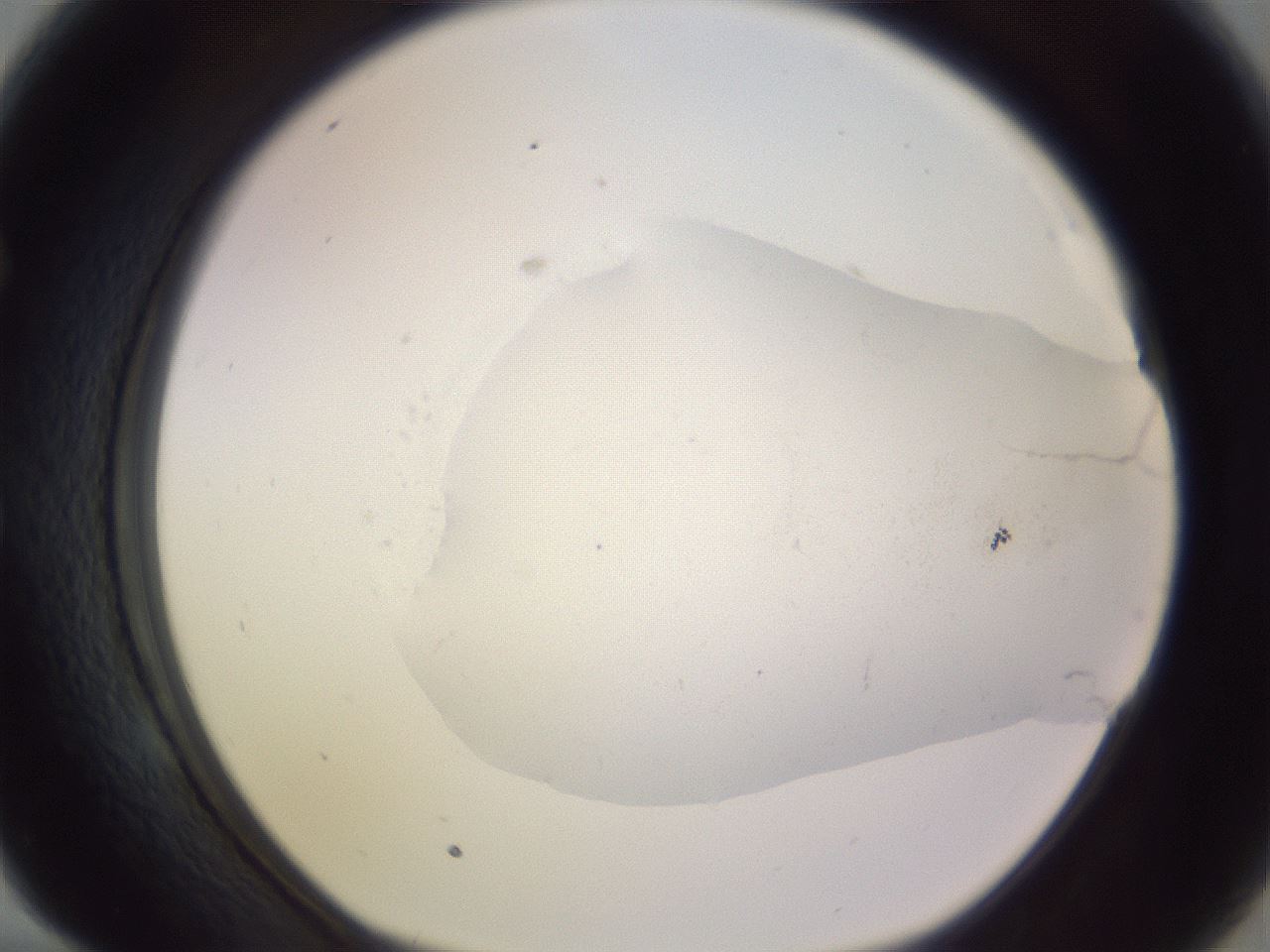 folderID951_plateID2951_batchID15816_wellNum58_profileID1_d1_r243577_ef.jpg