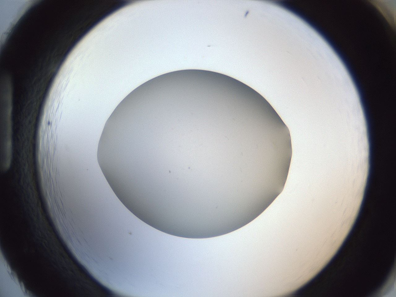 folderID965_plateID965_batchID1487_wellNum86_profileID1_d1_r37651_ef.jpg
