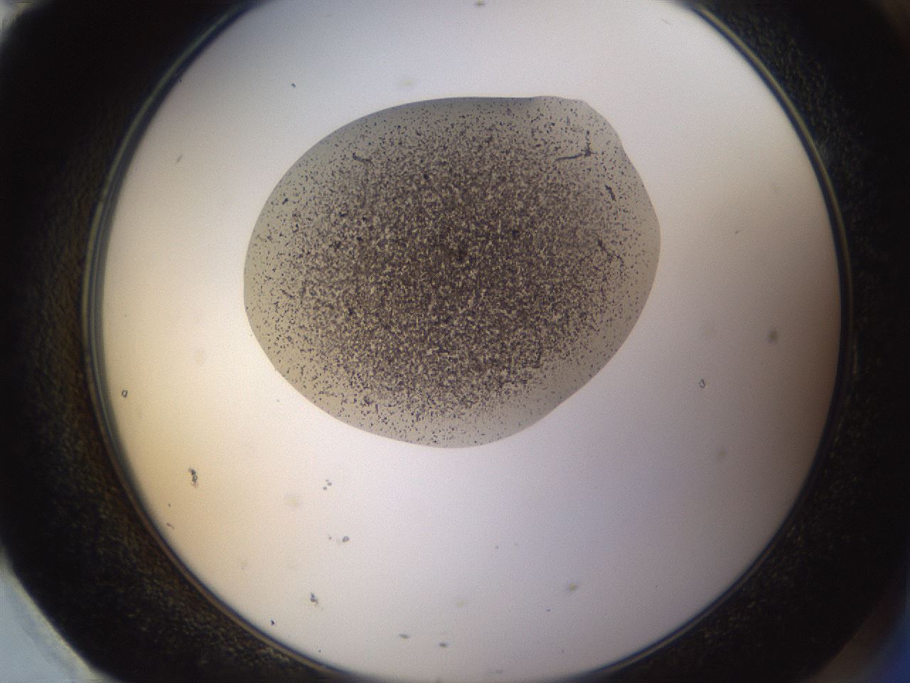 folderID107_plateID3107_batchID17921_wellNum95_profileID1_d2_r263334_ef.jpg