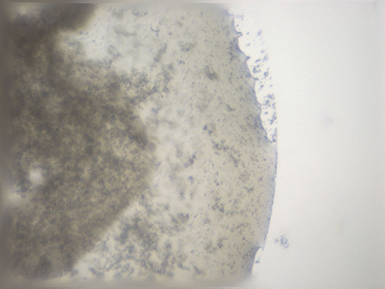 folderID16_plateID3016_batchID16579_wellNum80_profileID1_d1_r252491_ef.jpg