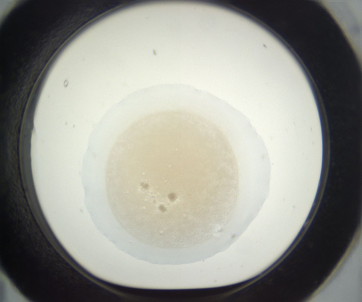 folderID381_plateID3381_batchID19953_wellNum95_profileID1_d1_r299281_ef.jpg