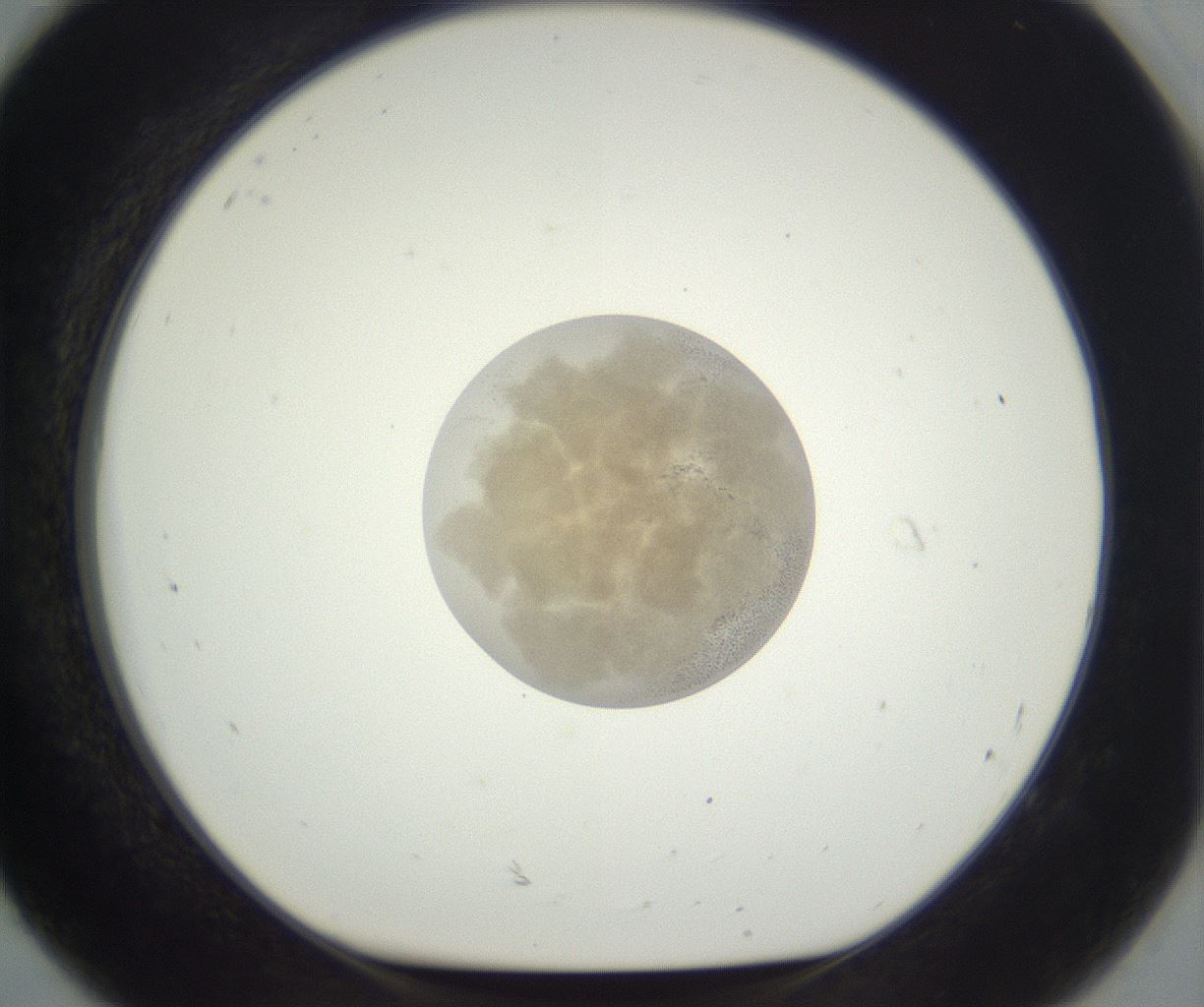 folderID396_plateID3396_batchID20298_wellNum92_profileID1_d1_r301582_ef.jpg
