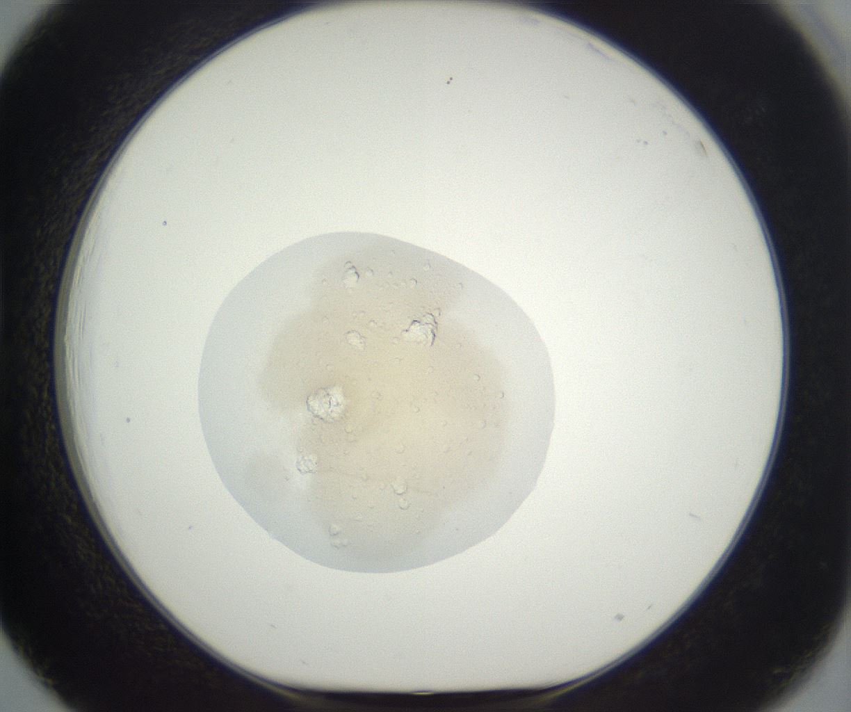 folderID398_plateID3398_batchID19712_wellNum39_profileID1_d1_r301721_ef.jpg