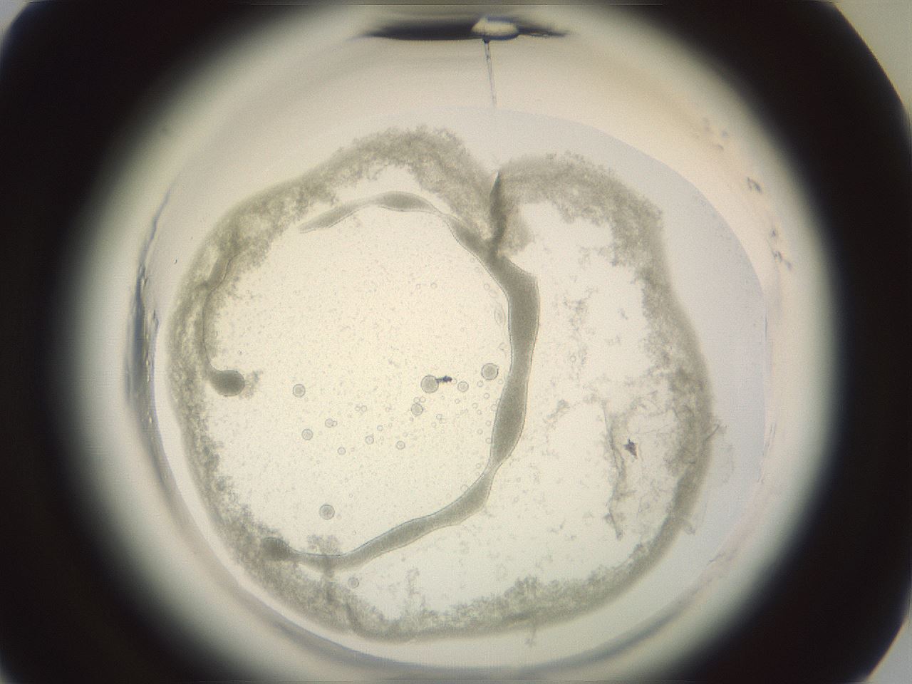 folderID577_plateID2577_batchID12827_wellNum41_profileID1_d3_r198563_ef.jpg