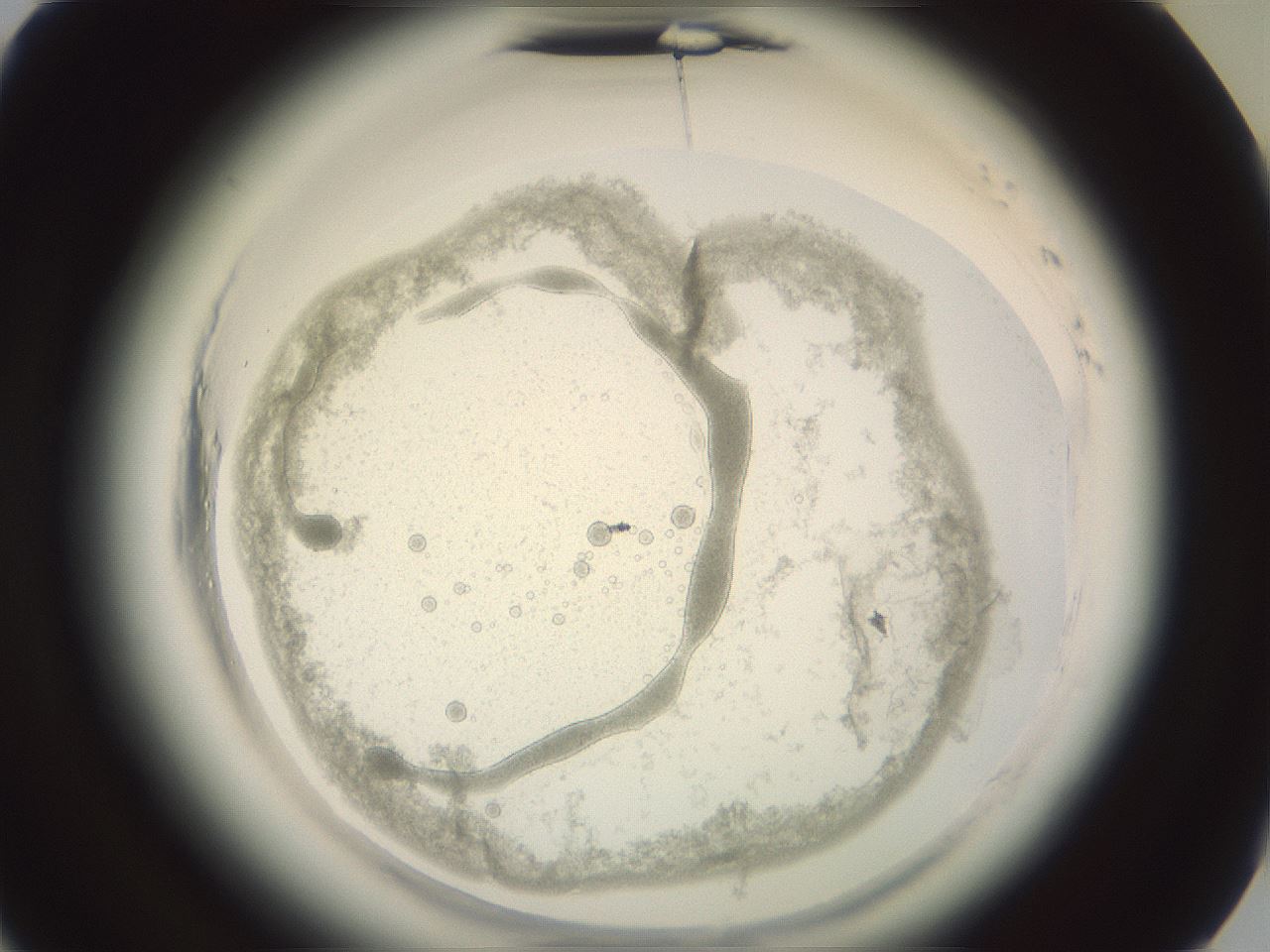folderID577_plateID2577_batchID12877_wellNum41_profileID1_d3_r198563_ef.jpg