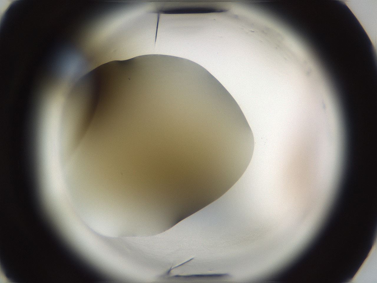 folderID587_plateID2587_batchID12880_wellNum2_profileID1_d3_r197870_ef.jpg