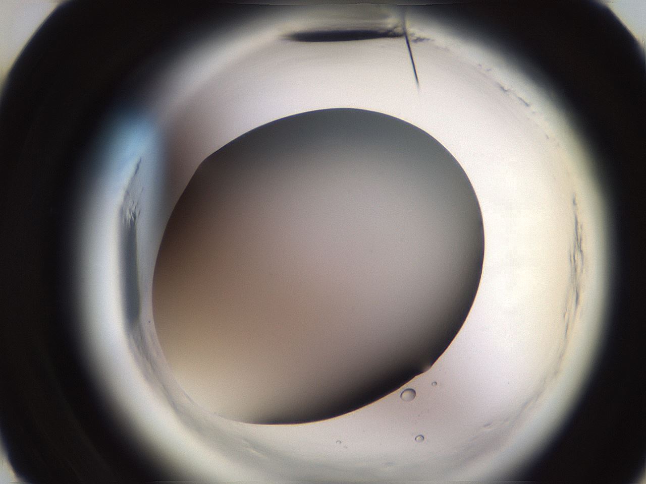 folderID589_plateID2589_batchID13856_wellNum10_profileID1_d3_r200198_ef.jpg