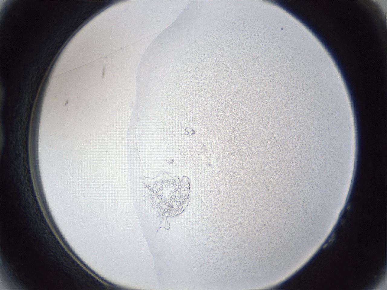 folderID641_plateID1641_batchID6832_wellNum14_profileID1_d1_r110026_ef.jpg