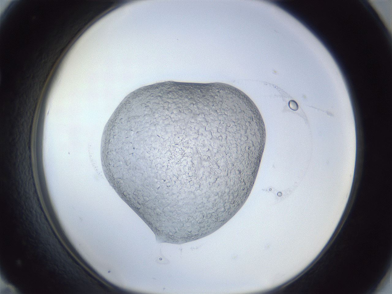 folderID925_plateID925_batchID1265_wellNum71_profileID1_d1_r33623_ef.jpg