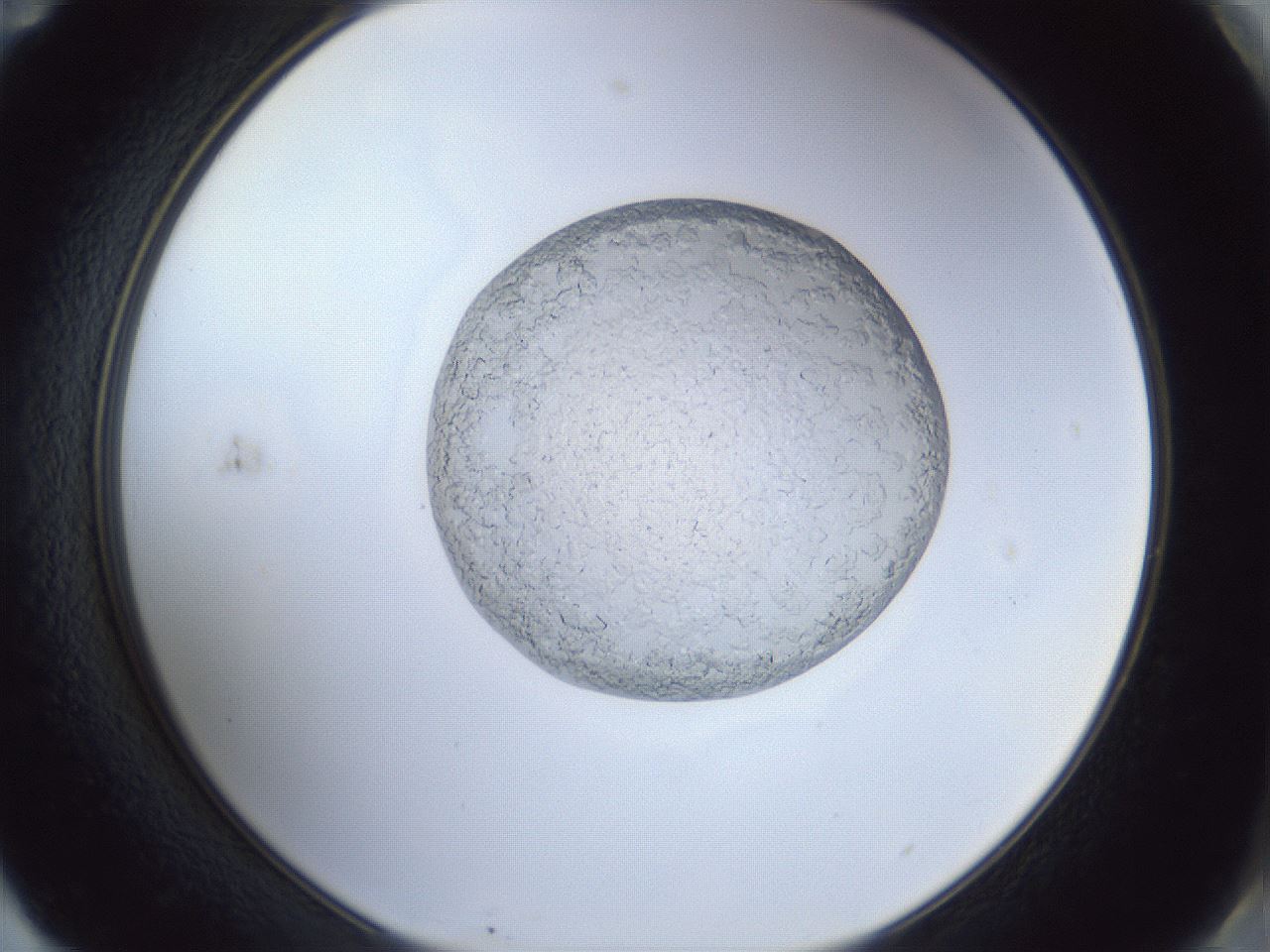 folderID925_plateID925_batchID1265_wellNum71_profileID1_d2_r33624_ef.jpg