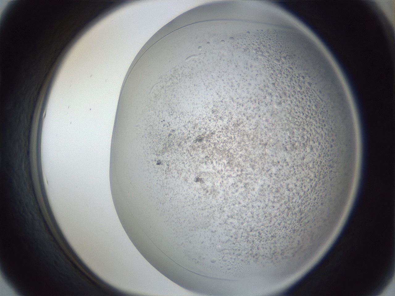 folderID966_plateID966_batchID1465_wellNum53_profileID1_d1_r37714_ef.jpg