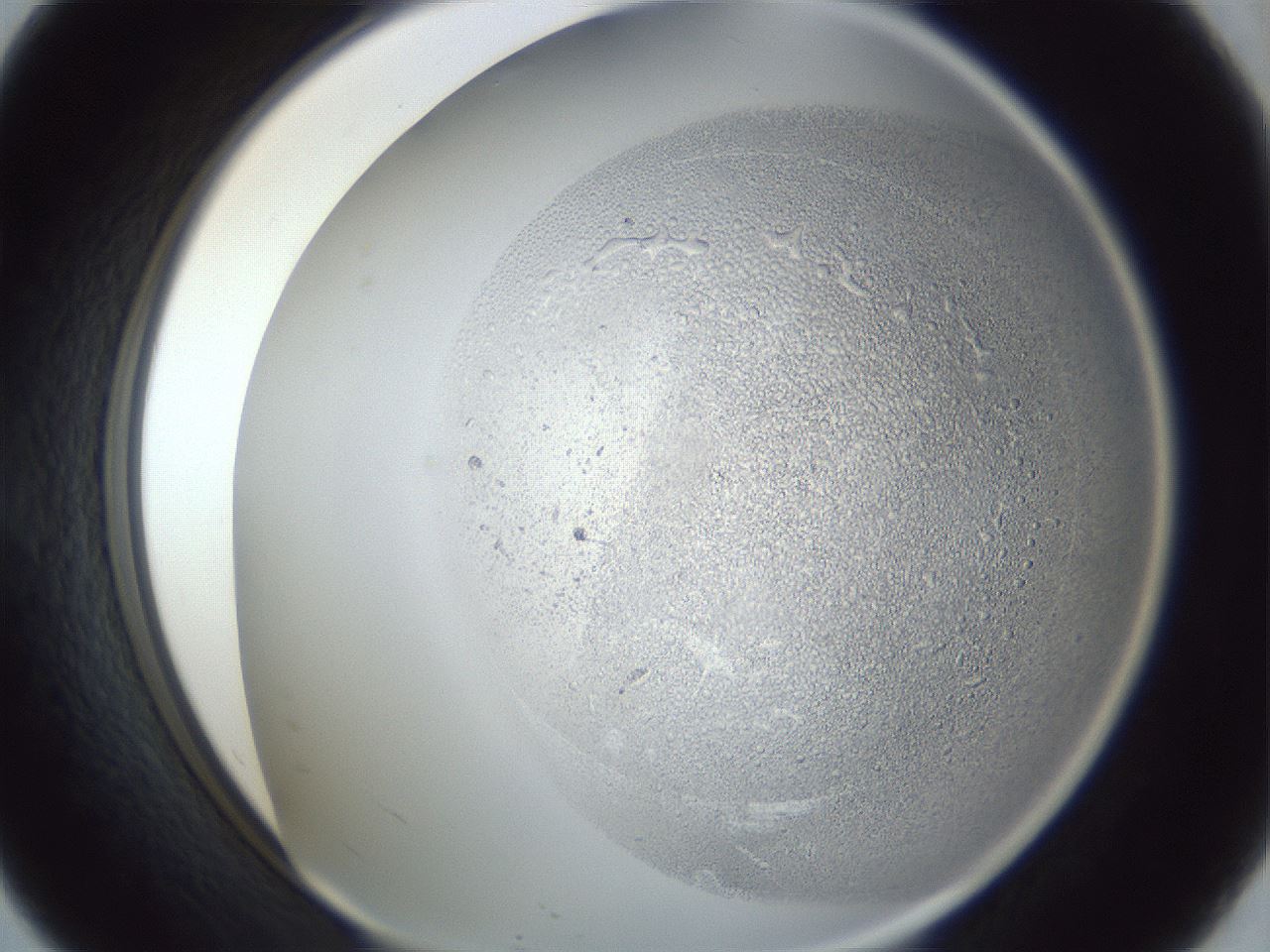 folderID966_plateID966_batchID1529_wellNum57_profileID1_d1_r37718_ef.jpg