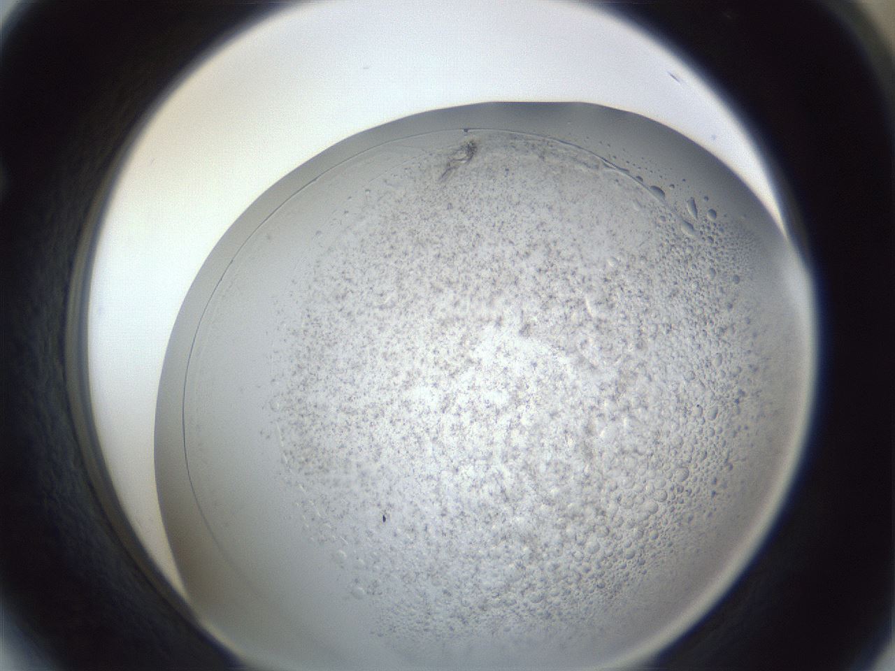 folderID966_plateID966_batchID1529_wellNum64_profileID1_d1_r37725_ef.jpg