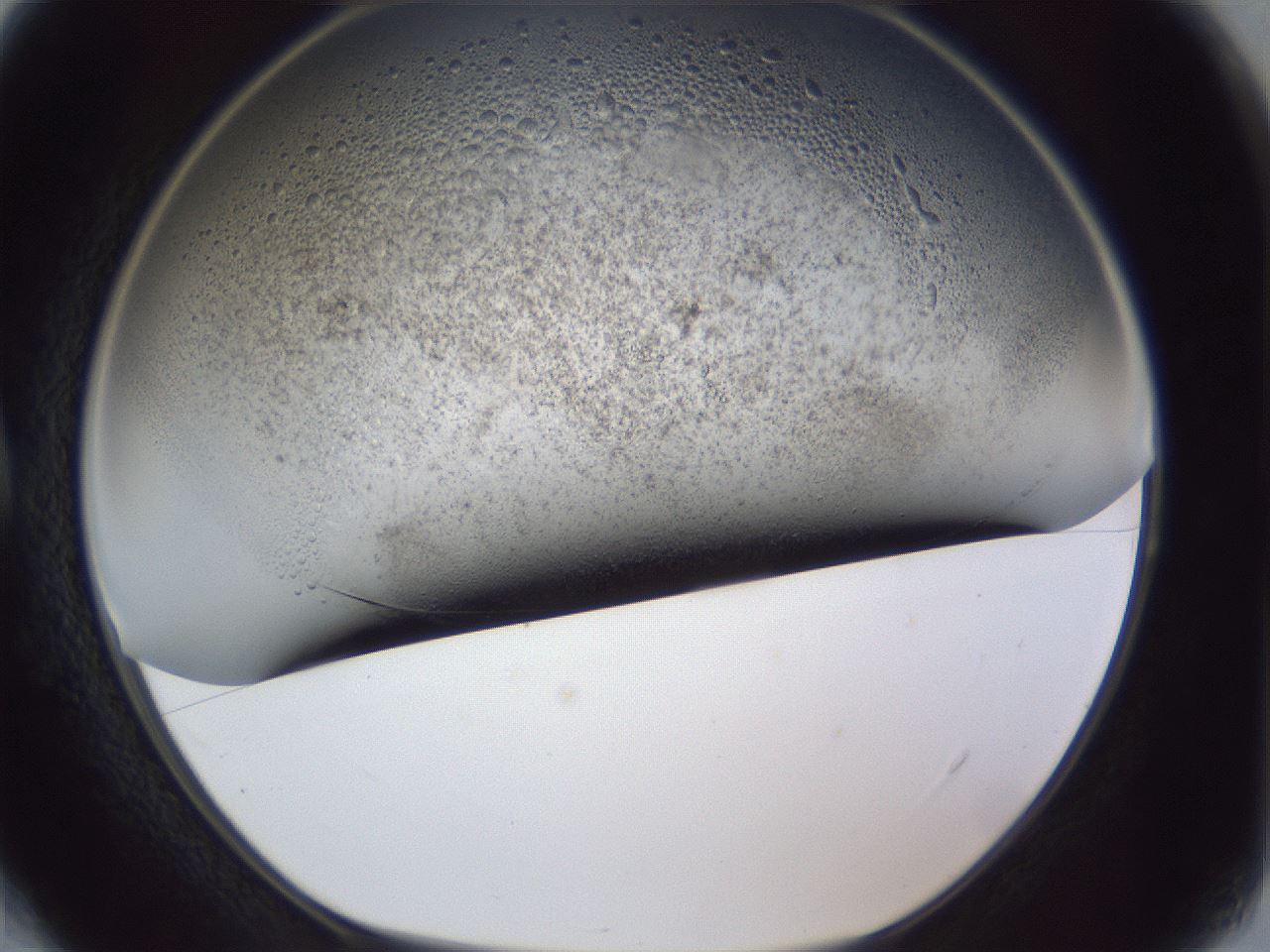 folderID966_plateID966_batchID1801_wellNum4_profileID1_d1_r37665_ef.jpg