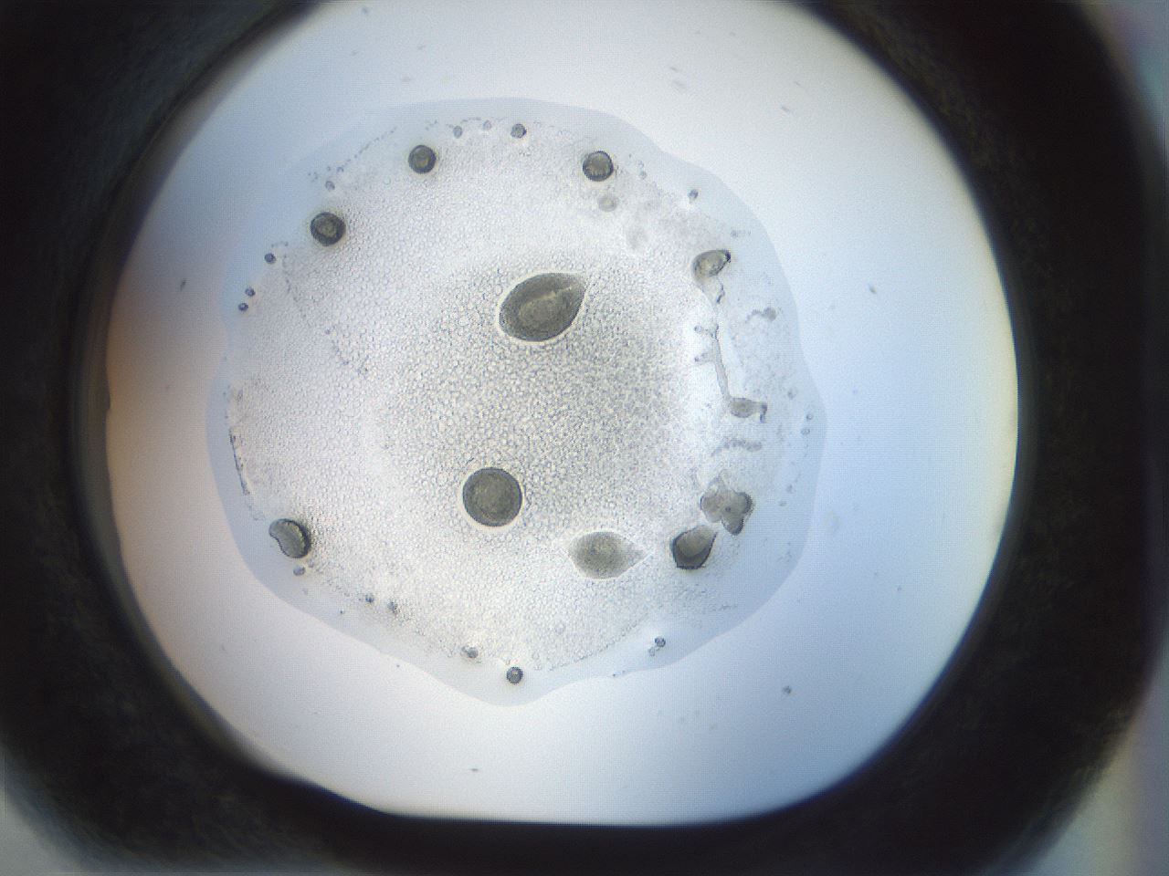 folderID985_plateID985_batchID1637_wellNum81_profileID1_d1_r40090_ef.jpg