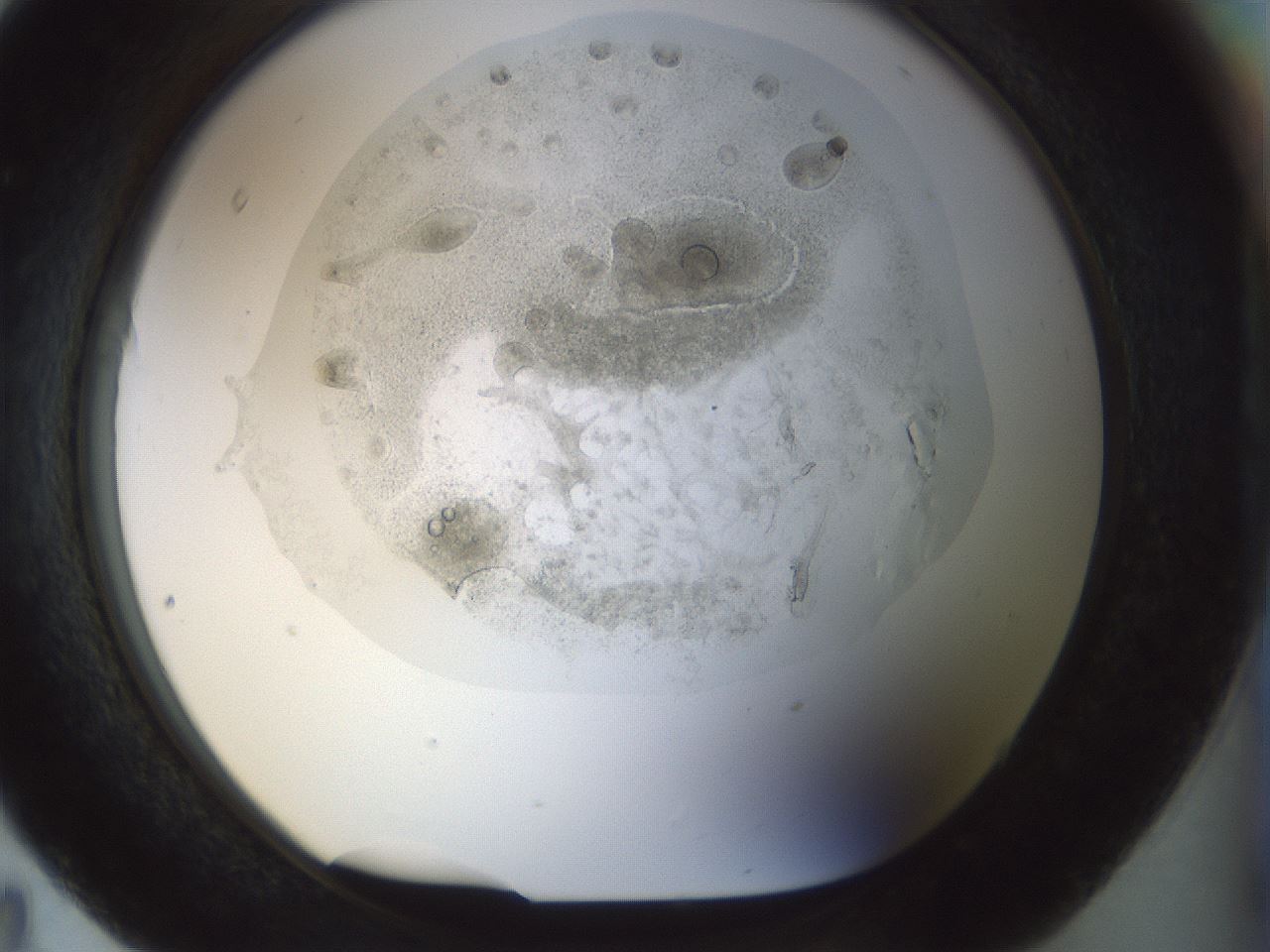 folderID985_plateID985_batchID1637_wellNum95_profileID1_d1_r40118_ef.jpg